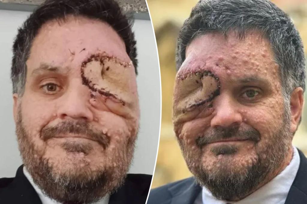 Man with facial disfigurement asked to leave restaurant for 'scaring customers'